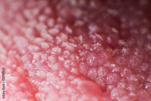 Super macro surface of tongue candidiasis overgrowth