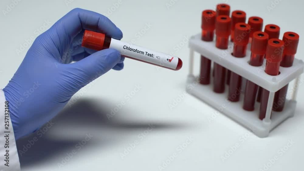 Positive Chloroform test, doctor showing blood sample in tube, health ...