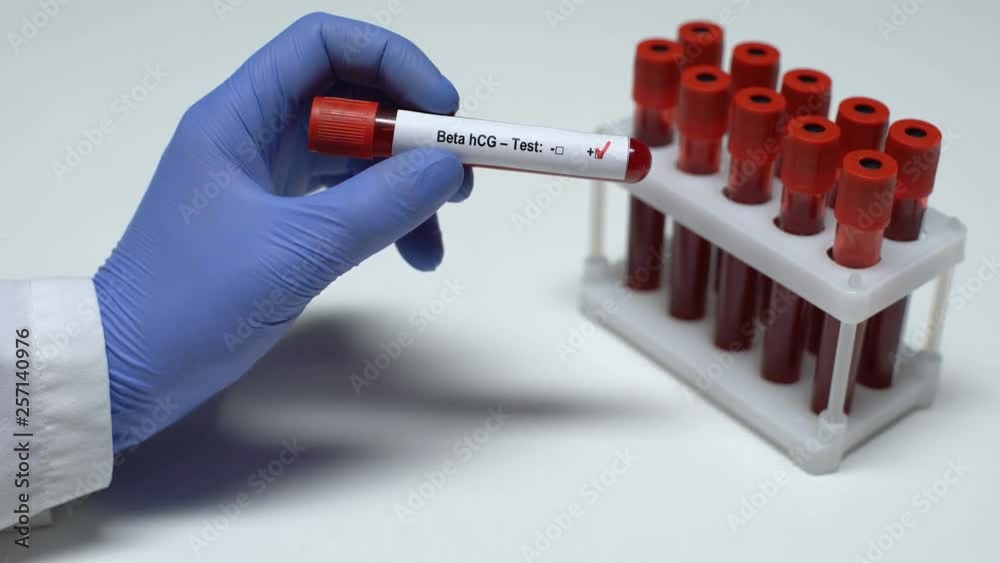 Positive Beta hCG test, doctor showing blood sample in tube, health