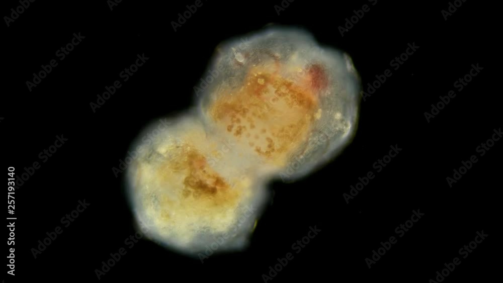 egg, embryo, cocoon of the worm Tubifex tubifex, under the microscope egg, embryo, cocoon of the worm Tubifex tubifex, under the microscope