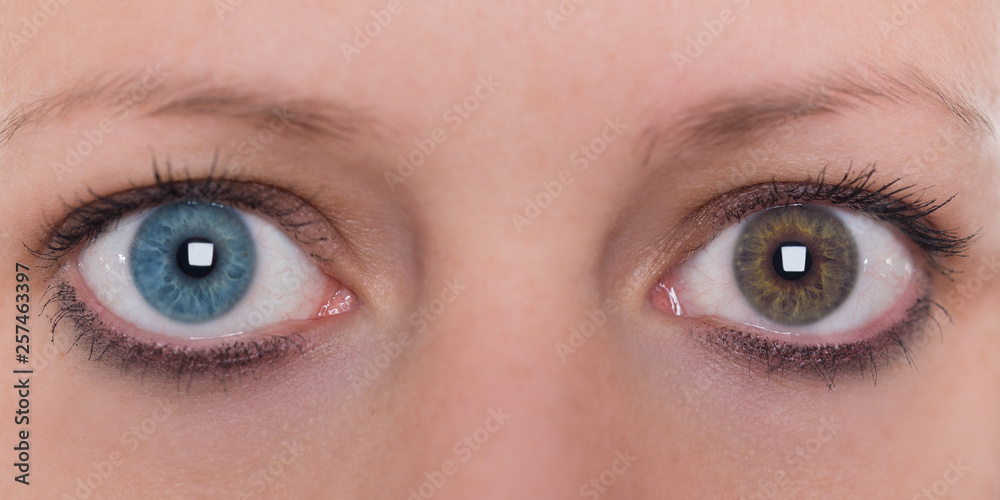 Frau mit Heterochromie, Augenfarbe blau und braun, Kontaktlinsen Stock  Photo | Adobe Stock