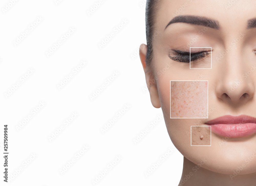Portrait of a beautiful woman on a white background, on the face are visible areas of problem skin - wrinkles and freckles. Cosmetology concept. - obrazy, fototapety, plakaty 