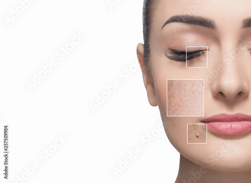 Portrait of a beautiful woman on a white background, on the face are visible areas of problem skin - wrinkles and freckles. Cosmetology concept.