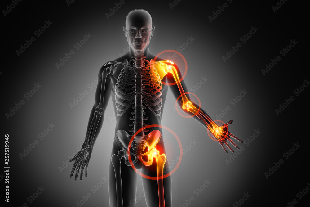 Schmerzen In Allen Muskeln Und Gelenken stock.adobe.com