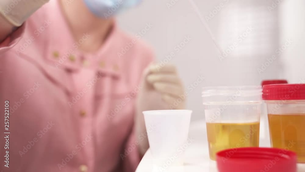 A demonstration video of a clinical laboratory scientist taking a sample of urine with pipette and dropping it into plastic cup. A demonstration video of a clinical laboratory scientist taking a sample of urine with pipette and dropping it into plastic cup.