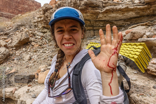 Woman with injured hand while hiking in Grand Canyon, Arizona, USA photo