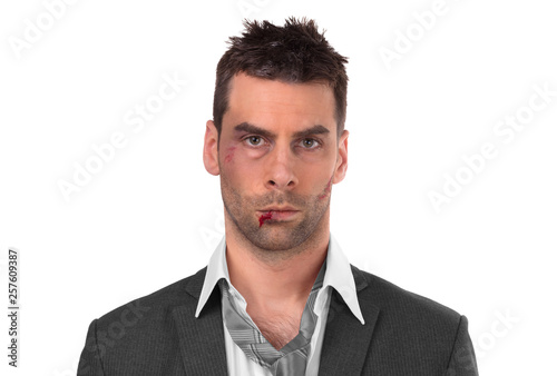 Φωτογραφία Close up of a businessman with bloody lip, beaten and bruised