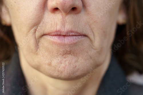 Close up detail of the chin of a middle-aged woman