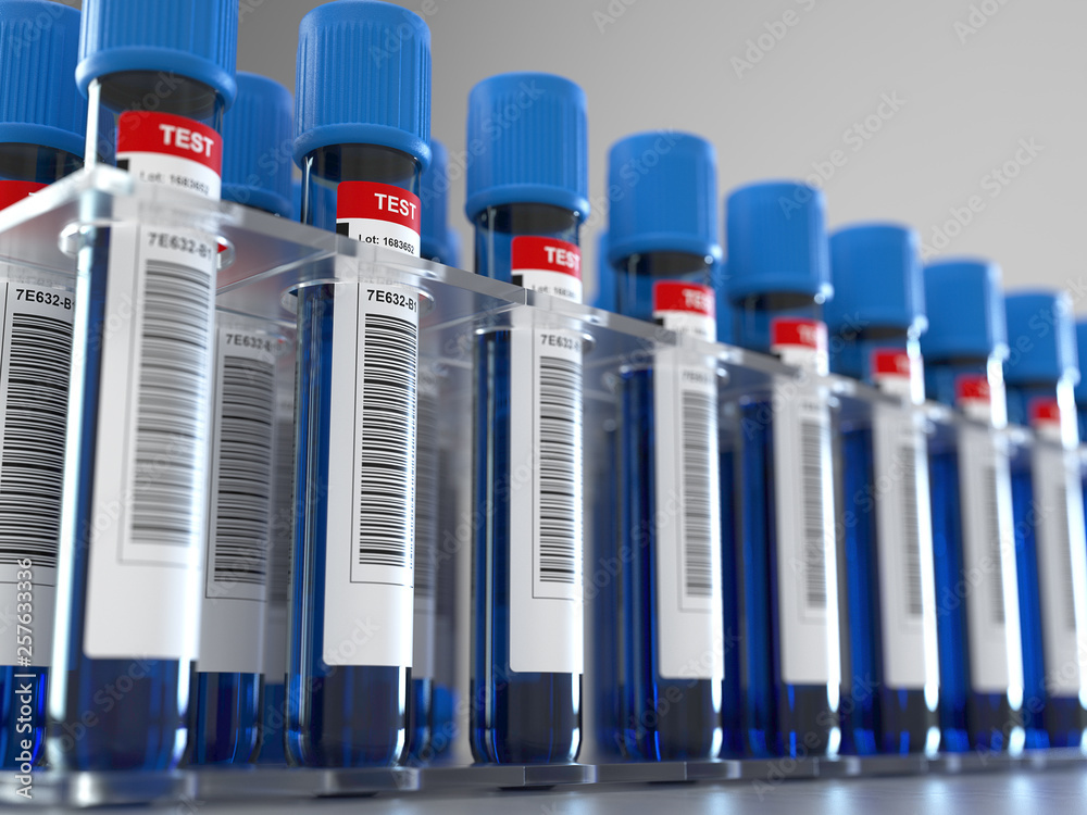 Tray tubes with blood samples labeled,rack of blood tubes, 3d rendering,conceptual image. Tray tubes with blood samples labeled,rack of blood tubes, 3d rendering,conceptual image.