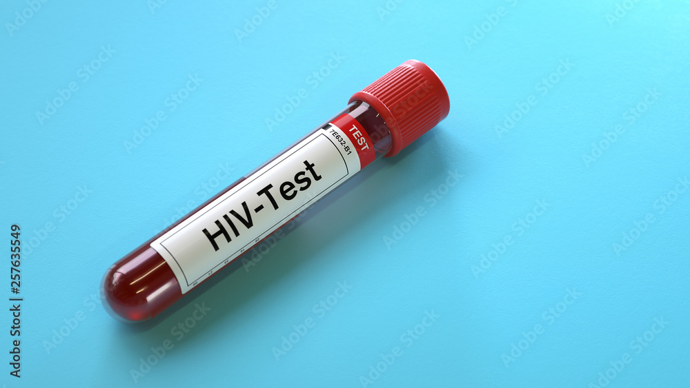 Blood sample for hiv virus test,3d rendering,conceptual image. Blood sample for hiv virus test,3d rendering,conceptual image.