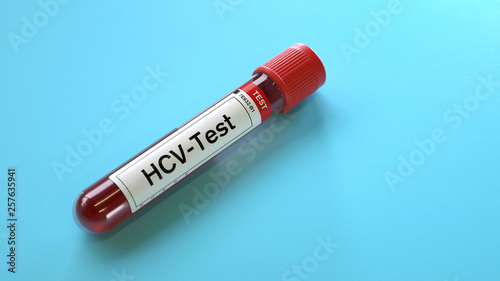 Blood sample for HCV virus test,3d rendering,conceptual image.