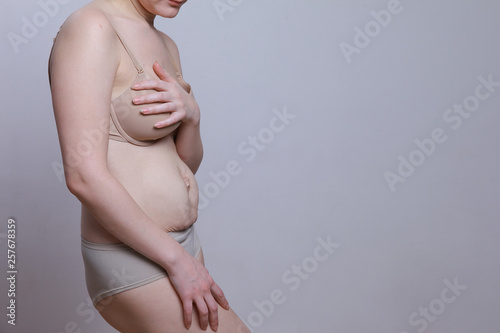 Wallpaper Mural A woman with a figure after giving birth. Stretch marks on the belly. side view Torontodigital.ca