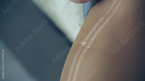 ripped nylon pantyhose on a woman's leg