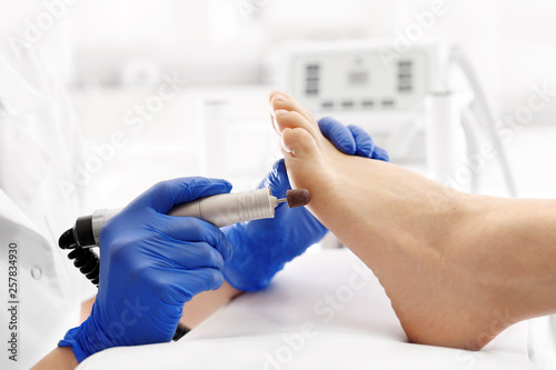Pedicure. Removal of corns and callus using a milling machine.