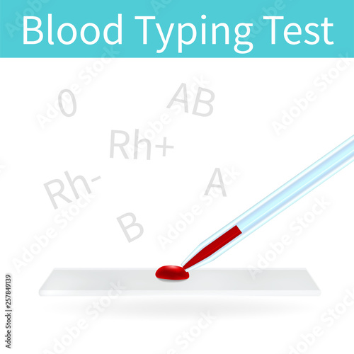 Blood typing test. Vector medical illustration. White background.