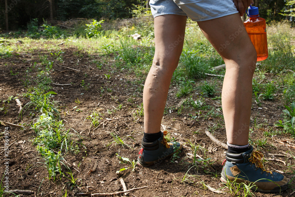 Woman with painful varicose veins on legs resting on a walk through nature.