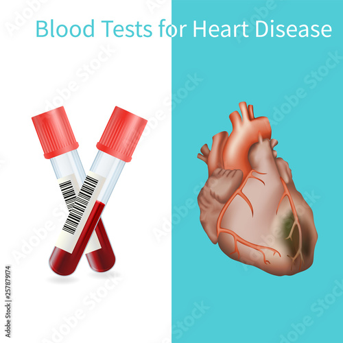 Blood tests for heart disease. Vector medical illustration. White background.