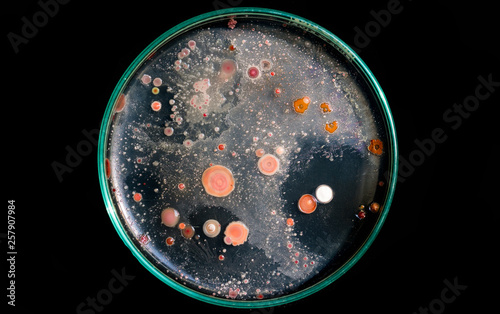 Top view soil microorganisms Nutrient agar in plate on black background. photo