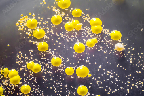 Bacteria grown from skin smear, colonies of Micrococcus luteus and Staphylococcus epidermidis on Petri dish with Tryptic soy agar, close-up view