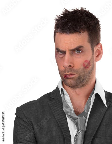 Close up of a businessman with bloody lip, beaten and bruised