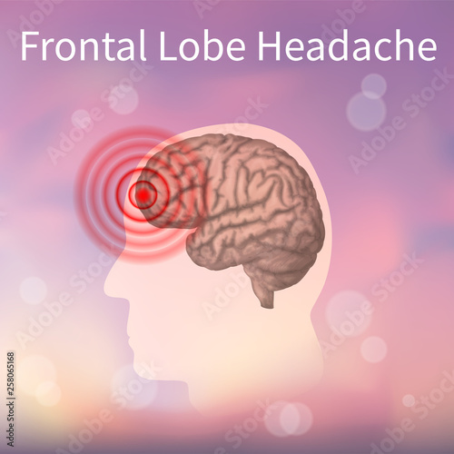 Front lobe headache. Vector realistic anatomy illustration. Pink abstract background.