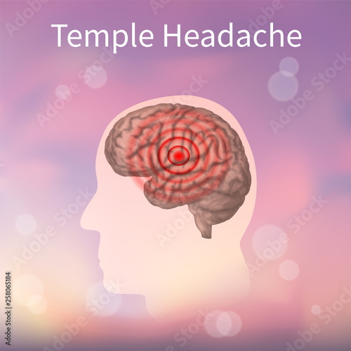 Temple headache. Vector realistic anatomy illustration. Pink abstract background.