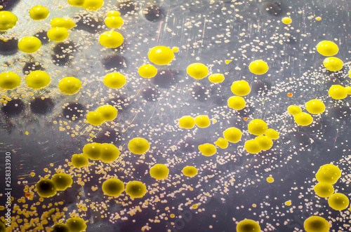 Bacteria grown from skin smear, colonies of Micrococcus luteus and Staphylococcus epidermidis on Petri dish with Tryptic soy agar, close-up view photo