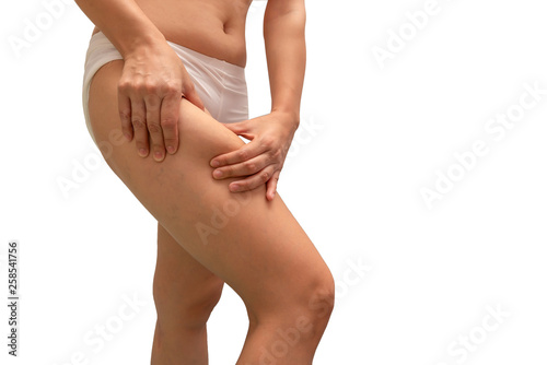 Asian women grabbing skin on her leg.