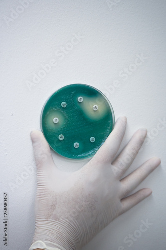 Disc diffusion of Pseudomonas aeruginosa on Mueller-Hinton agar