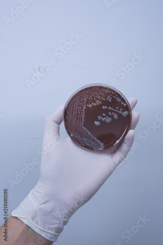 Bacteria colonies on Chocolate agar
