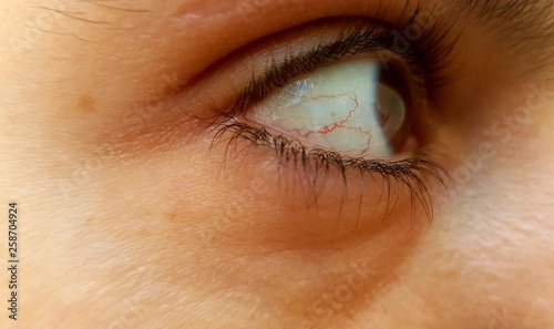 The arteries of the eye form the heart photo
