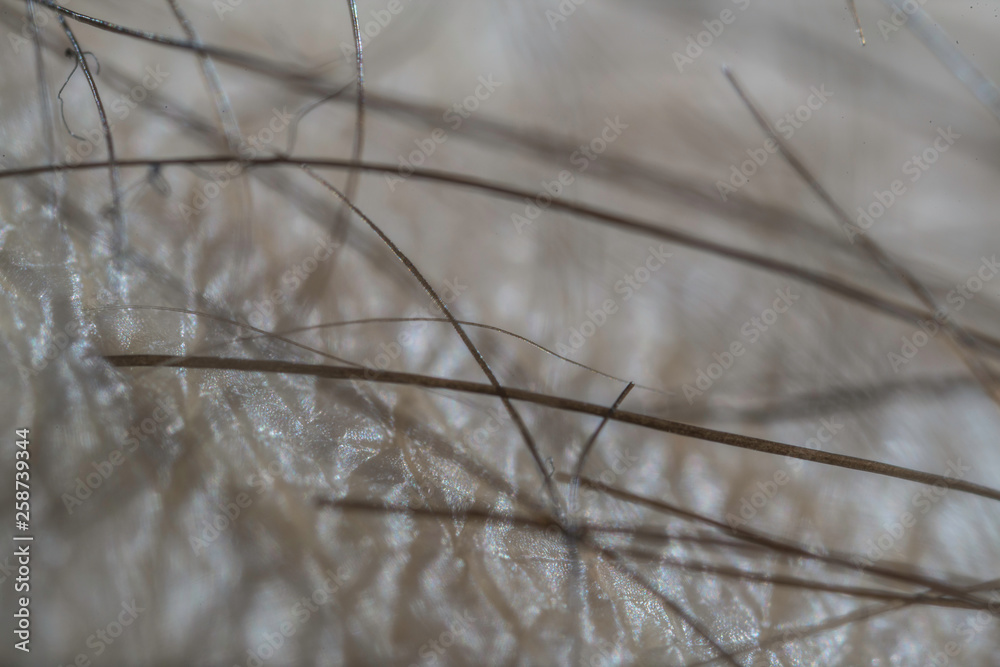 Skin Texture Skin Texture