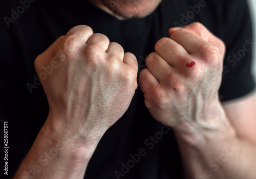 Wallpaper Mural boxing fists with blood close up. motivation. Torontodigital.ca