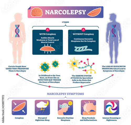 Narcolepsy vector illustration. Labeled muscle strength disease infographic photo