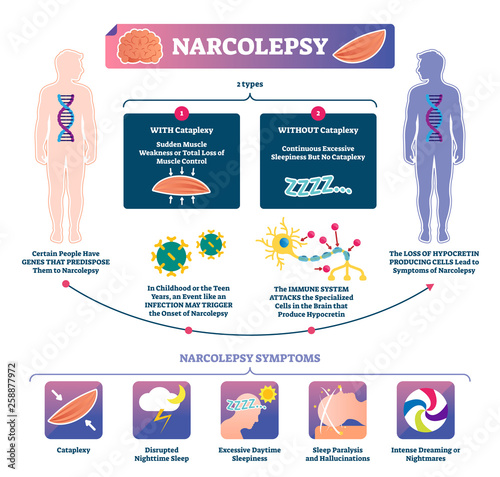 Narcolepsy vector illustration. Labeled muscle strength disease infographic