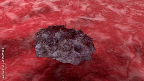 3D rendered animation of a growing Cancer Tumor on healthy tissue.