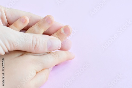 The doctor holds a small hand of a child affected with warts on little fingers and back of the hand. Papillomavirus in a child's hand and fingers. Pediatric dermatology. Skin diseases