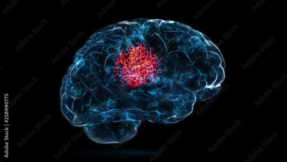 Digital Brain Data with Localized Memory of Information