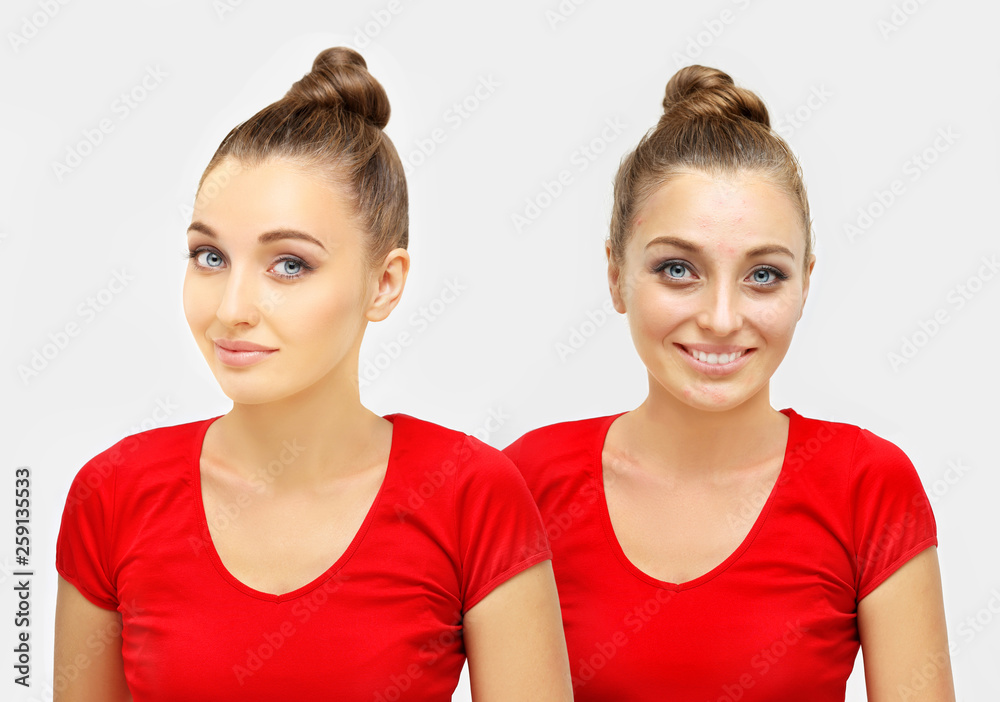 The Secret of Makeup. Before- After,Portrait of beautiful girl with problem and clear skin The Secret of Makeup. Before- After,Portrait of beautiful girl with problem and clear skin
