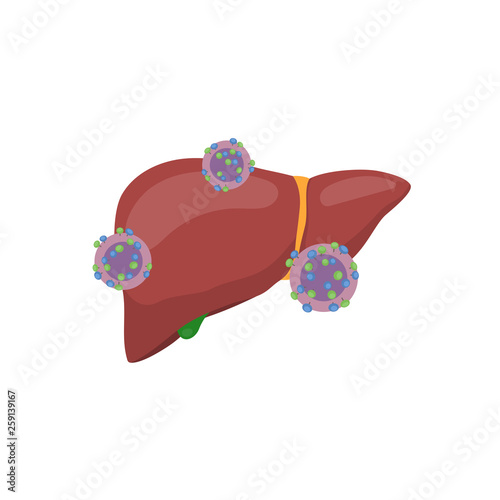Hepatitis C virus attacks the liver