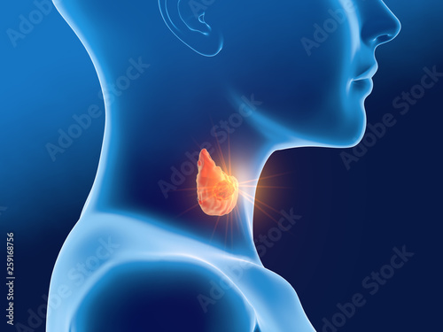 Thyroid cancer of a woman, medically 3D illustration, front view photo