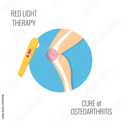 Osteoarthritis illustration. Red light therapy