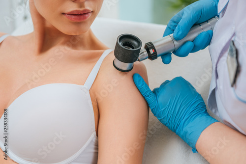 Cropped view of doctor using magnifier during mole removing procedure