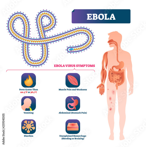 Ebola vector illustration. Labeled virus bacteria infection symptoms scheme photo