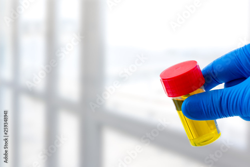 Doctor holds urine sample for test and analysis conceptual image on white background