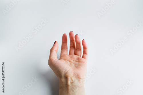  Female hand with a scar on her wrist lies on a white background