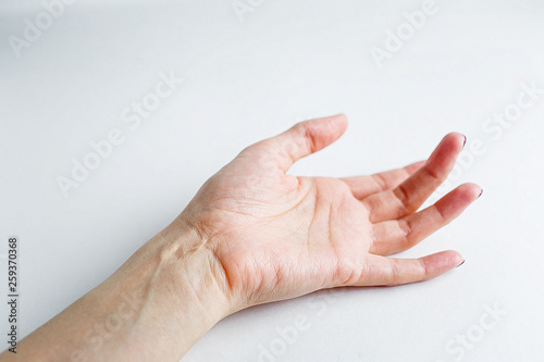  Female hand with a scar on her wrist lies on a white background