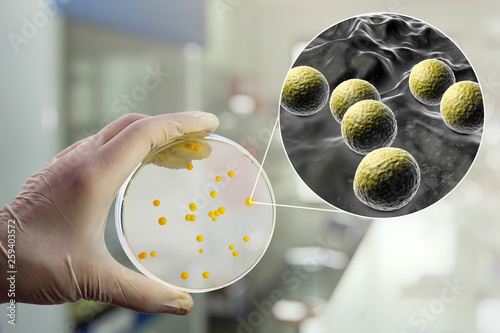 Colonies of Micrococcus luteus bacteria on agar plate and close up view of micrococci bacteria, photo and 3D illustration photo