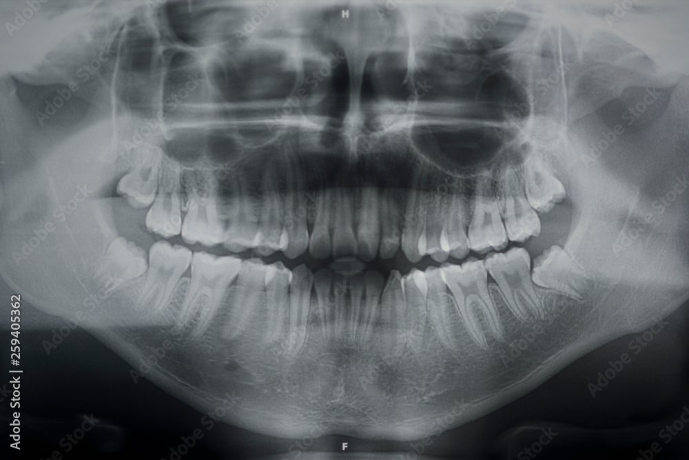 Naklejka premium Utilitarios de dentista profesional