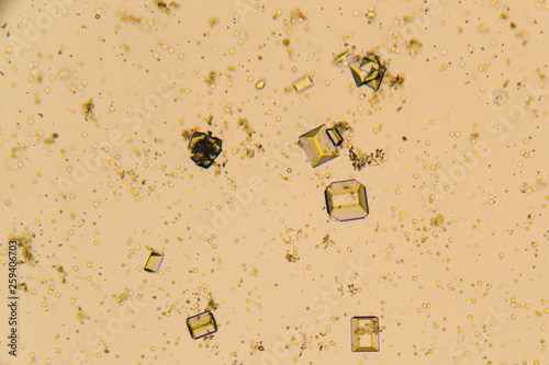 Urine crystals, red blood cells and leukocytes at the microscope. Urinary tract disease in cat